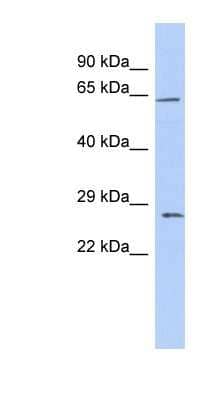 Western Blot: Claudin-18 Antibody [NBP1-59250]