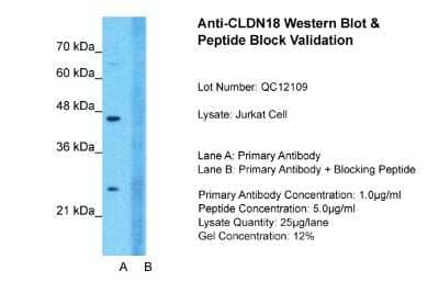 Western Blot: Claudin-18 Antibody [NBP1-60010]