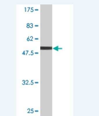 Western Blot: Claudin-19 Antibody (2F2) [H00149461-M02]