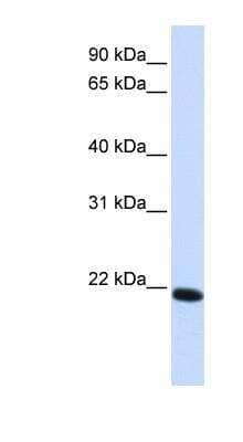 Western Blot: Claudin-19 Antibody [NBP1-59277]