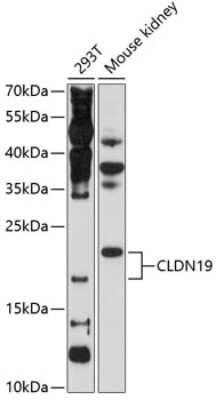 Western Blot: Claudin-19 AntibodyBSA Free [NBP2-92415]