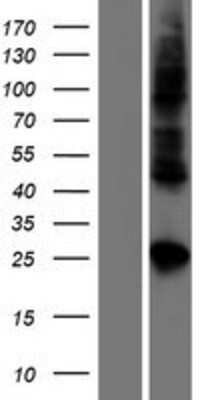 Western Blot: Claudin-19 Overexpression Lysate [NBP2-05422]