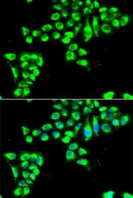 Immunocytochemistry/ Immunofluorescence: Claudin-2 Antibody - BSA Free [NBP2-91000]