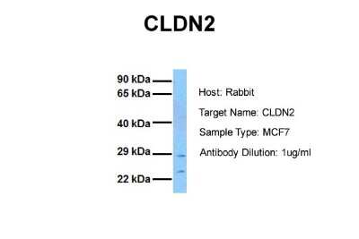 Western Blot: Claudin-2 Antibody [NBP2-82696]