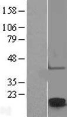 Western Blot: Claudin-2 Overexpression Lysate [NBL1-09243]