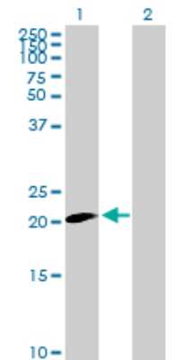 Western Blot: Claudin-20 Antibody [H00049861-B01P]