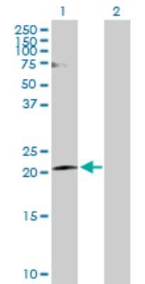 Western Blot: Claudin-20 Antibody [H00049861-D01P]