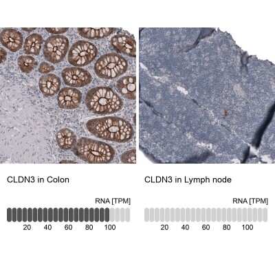Immunohistochemistry-Paraffin: Claudin-3 Antibody (CL13128) [NBP3-18577]