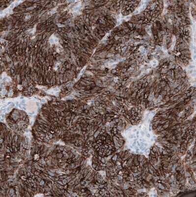 Immunohistochemistry-Paraffin: Claudin-3 Antibody (CL13128) [NBP3-18577]