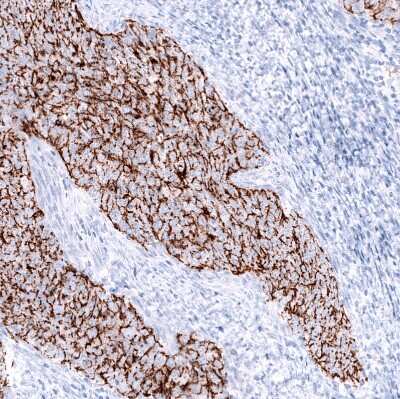 Immunohistochemistry-Paraffin: Claudin-3 Antibody (CL13128) [NBP3-18577]
