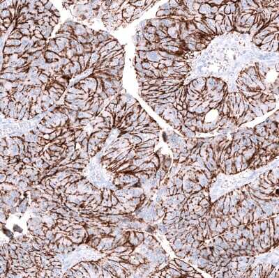 Immunohistochemistry-Paraffin: Claudin-3 Antibody (CL13128) [NBP3-18577]