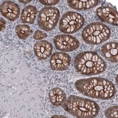 Immunohistochemistry-Paraffin: Claudin-3 Antibody (CL13128) [NBP3-18577]