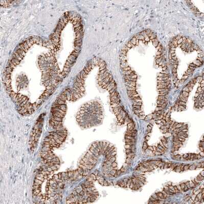 Immunohistochemistry-Paraffin: Claudin-3 Antibody (CL13128) [NBP3-18577]