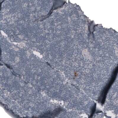 Immunohistochemistry-Paraffin: Claudin-3 Antibody (CL13128) [NBP3-18577]