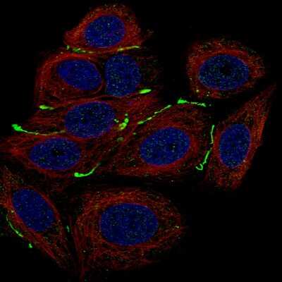 Immunocytochemistry/ Immunofluorescence: Claudin-3 Antibody (CL13129) [NBP3-18563]