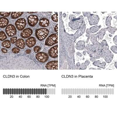 Immunohistochemistry-Paraffin: Claudin-3 Antibody (CL13129) [NBP3-18563]