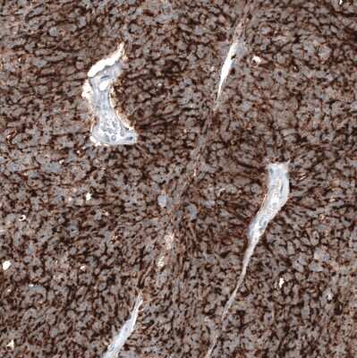 Immunohistochemistry-Paraffin: Claudin-3 Antibody (CL13129) [NBP3-18563]