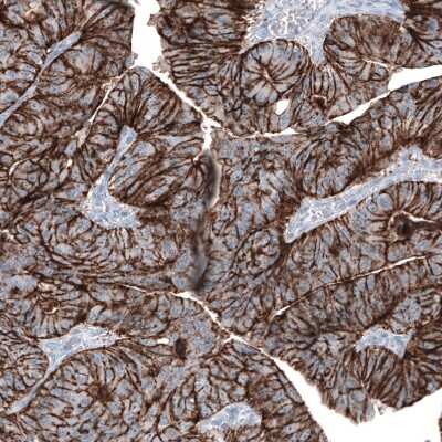 Immunohistochemistry-Paraffin: Claudin-3 Antibody (CL13129) [NBP3-18563]