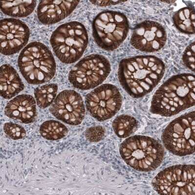 Immunohistochemistry-Paraffin: Claudin-3 Antibody (CL13129) [NBP3-18563]