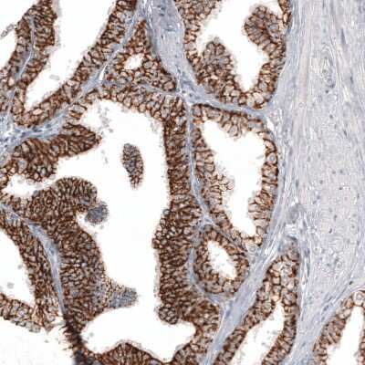 Immunohistochemistry-Paraffin: Claudin-3 Antibody (CL13129) [NBP3-18563]