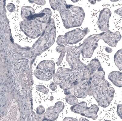 Immunohistochemistry-Paraffin: Claudin-3 Antibody (CL13129) [NBP3-18563]
