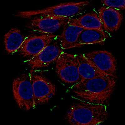 Immunocytochemistry/ Immunofluorescence: Claudin-3 Antibody (CL13130) [NBP3-18555]