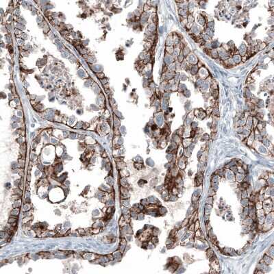Immunohistochemistry-Paraffin: Claudin-3 Antibody (CL13130) [NBP3-18555]