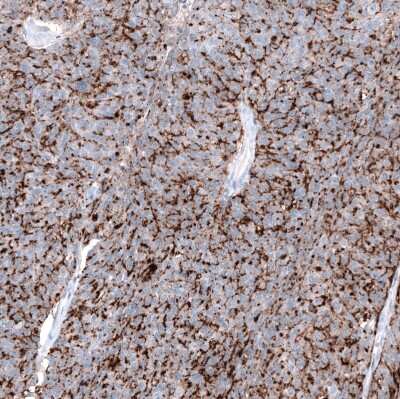 Immunohistochemistry-Paraffin: Claudin-3 Antibody (CL13130) [NBP3-18555]
