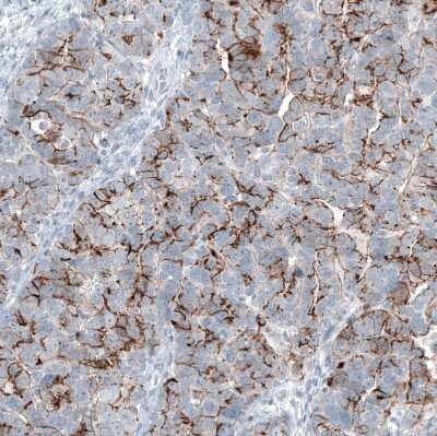 Immunohistochemistry-Paraffin: Claudin-3 Antibody (CL13130) [NBP3-18555]