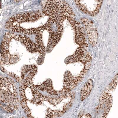 Immunohistochemistry-Paraffin: Claudin-3 Antibody (CL13130) [NBP3-18555]