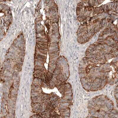 Immunohistochemistry-Paraffin: Claudin-3 Antibody (CL13130) [NBP3-18555]