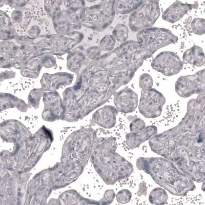 Immunohistochemistry-Paraffin: Claudin-3 Antibody (CL13130) [NBP3-18555]