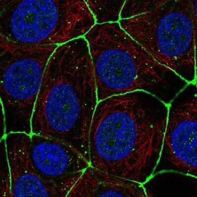 Immunocytochemistry/ Immunofluorescence: Claudin-3 Antibody [NBP2-48526]