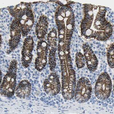 Immunohistochemistry-Paraffin: Claudin-3 Antibody [NBP2-48526]