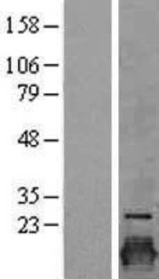 Western Blot: Claudin-3 Overexpression Lysate [NBL1-09245]