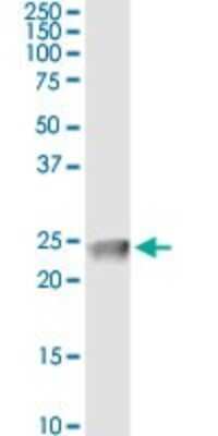 Immunoprecipitation: Claudin-4 Antibody (4A11) [H00001364-M02]