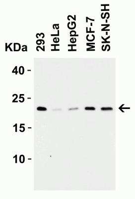 Western Blot: Claudin-4 AntibodyBSA Free [NBP2-41187]
