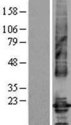 Western Blot: Claudin-4 Overexpression Lysate [NBL1-09246]