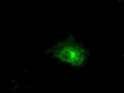 Immunocytochemistry/ Immunofluorescence: Claudin-5 Antibody (OTI1G4) [NBP2-02259]
