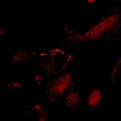 Immunocytochemistry/ Immunofluorescence: Claudin-5 Antibody (OTI1G4) [NBP2-02259]