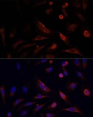 Immunocytochemistry/ Immunofluorescence: Claudin-5 Antibody - Azide and BSA Free [NBP2-92846]