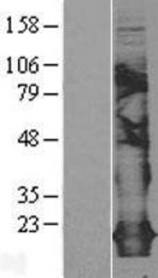 Western Blot: Claudin-5 Overexpression Lysate [NBL1-09247]