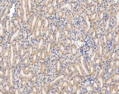 Immunohistochemistry-Paraffin: Claudin-6 Antibody [NBP3-12787]