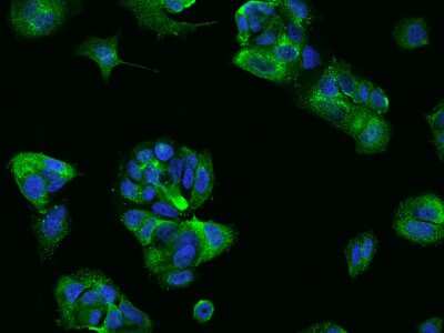 Immunocytochemistry/ Immunofluorescence: Claudin-7 Antibody [NBP2-97417]