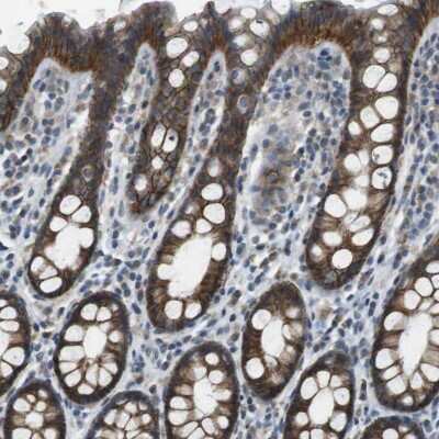 Immunohistochemistry-Paraffin: Claudin-7 Antibody [NBP1-85683]