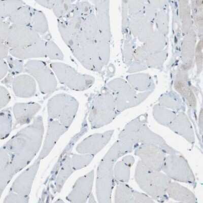 Immunohistochemistry-Paraffin: Claudin-7 Antibody [NBP1-85683]