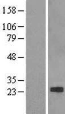 Western Blot: Claudin-7 Overexpression Lysate [NBL1-09249]