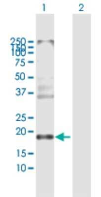 Western Blot: Claudin-8 Antibody [H00009073-B01P]