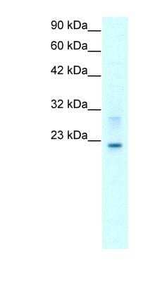 Western Blot: Claudin-9 Antibody [NBP1-59156]