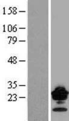 Western Blot: Claudin-9 Overexpression Lysate [NBL1-09251]